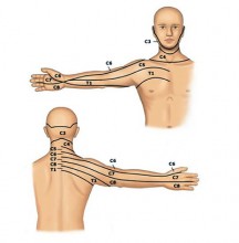 Nerve Roots